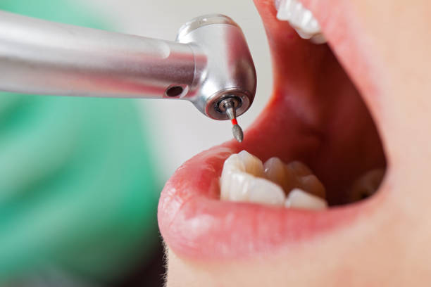Best Pediatric Emergency Dentist in Fortuna Foothills, AZ